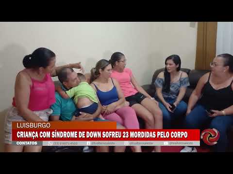 MENINO É MORDIDO 23 VEZES EM CRECHE DE LUISBURGO/MG